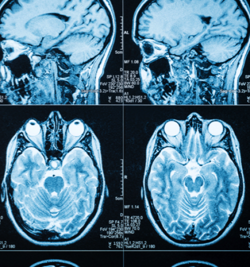 ENFERMAGEM EM NEUROLOGIA